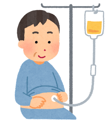 胃ろうのイラスト