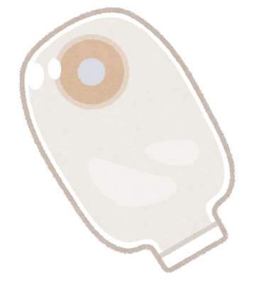 ストーマのイラスト