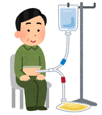 腹膜透析のイラスト